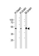 NUDEL / NDEL1 Antibody - Western blot of lysates from human heart, human brain, mouse brain tissue lysate (from left to right), using NDEL1 antibody diluted at 1:1000 at each lane. A goat anti-rabbit IgG H&L (HRP) at 1:10000 dilution was used as the secondary antibody. Lysates at 20 ug per lane.