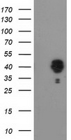 NUDEL / NDEL1 Antibody - HEK293T cells were transfected with the pCMV6-ENTRY control (Left lane) or pCMV6-ENTRY NDEL1 (Right lane) cDNA for 48 hrs and lysed. Equivalent amounts of cell lysates (5 ug per lane) were separated by SDS-PAGE and immunoblotted with anti-NDEL1.