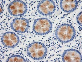 NUDEL / NDEL1 Antibody - IHC of paraffin-embedded Human colon tissue using anti-NDEL1 mouse monoclonal antibody.