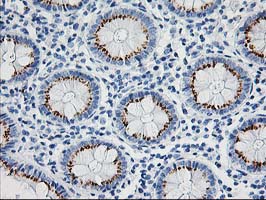 NUDEL / NDEL1 Antibody - IHC of paraffin-embedded Human colon tissue using anti-NDEL1 mouse monoclonal antibody.