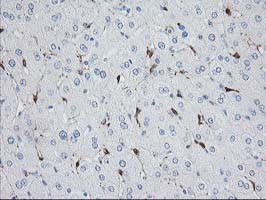 NUDEL / NDEL1 Antibody - IHC of paraffin-embedded Human liver tissue using anti-NDEL1 mouse monoclonal antibody.