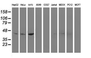 NUDEL / NDEL1 Antibody - Western blot of extracts (35 ug) from 9 different cell lines by using anti-NDEL1 monoclonal antibody.
