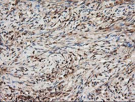 NUDEL / NDEL1 Antibody - IHC of paraffin-embedded Human Ovary tissue using anti-NDEL1 mouse monoclonal antibody.