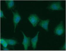 NUDT1 / MTH1 Antibody - ICC/IF analysis of NUDT1 in A549 cells line, stained with DAPI (Blue) for nucleus staining and monoclonal anti-human NUDT1 antibody (1:100) with goat anti-mouse IgG-Alexa fluor 488 conjugate (Green).