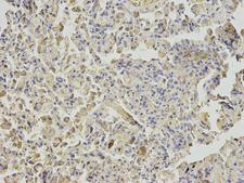 NUDT1 / MTH1 Antibody - Immunohistochemistry of paraffin-embedded human lung using NUDT1 antibody at dilution of 1:200 (200x lens).