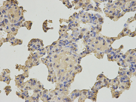 NUDT1 / MTH1 Antibody - Immunohistochemistry of paraffin-embedded rat lung using NUDT1 antibody at dilution of 1:200 (400x lens).