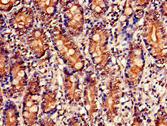NUDT1 / MTH1 Antibody - Immunohistochemistry of paraffin-embedded human small intestine tissue using NUDT1 Antibody at dilution of 1:100