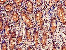 NUDT1 / MTH1 Antibody - Immunohistochemistry of paraffin-embedded human small intestine tissue using NUDT1 Antibody at dilution of 1:100