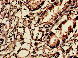 NUDT1 / MTH1 Antibody - Immunohistochemistry of paraffin-embedded human appendix tissue using NUDT1 Antibody at dilution of 1:100