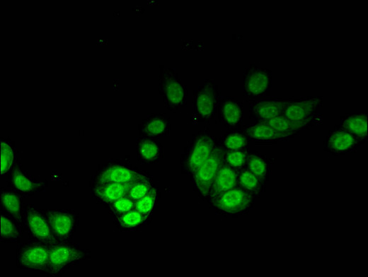 NUDT1 / MTH1 Antibody - Immunofluorescent analysis of PC3 cells using NUDT1 Antibody at a dilution of 1:100 and Alexa Fluor 488-congugated AffiniPure Goat Anti-Rabbit IgG(H+L)