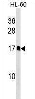 NUDT10 Antibody - NUDT10 Antibody western blot of HL-60 cell line lysates (35 ug/lane). The NUDT10 Antibody detected the NUDT10 protein (arrow).