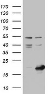 NUDT10 Antibody - HEK293T cells were transfected with the pCMV6-ENTRY control. (Left lane) or pCMV6-ENTRY NUDT10. (Right lane) cDNA for 48 hrs and lysed. Equivalent amounts of cell lysates. (5 ug per lane) were separated by SDS-PAGE and immunoblotted with anti-NUDT10.