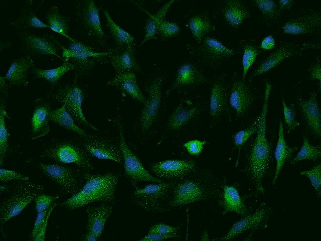 NUDT10 Antibody - Immunofluorescence staining of NUDT10 in U251MG cells. Cells were fixed with 4% PFA, permeabilzed with 0.1% Triton X-100 in PBS, blocked with 10% serum, and incubated with rabbit anti-Human NUDT10 polyclonal antibody (dilution ratio 1:200) at 4°C overnight. Then cells were stained with the Alexa Fluor 488-conjugated Goat Anti-rabbit IgG secondary antibody (green) and counterstained with DAPI (blue). Positive staining was localized to Cytoplasm.