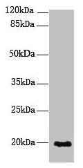 NUDT11 Antibody - Western blot All lanes: NUDT11 antibody at 2µg/ml + U251 whole cell lysate Secondary Goat polyclonal to rabbit IgG at 1/10000 dilution Predicted band size: 19 kDa Observed band size: 19 kDa