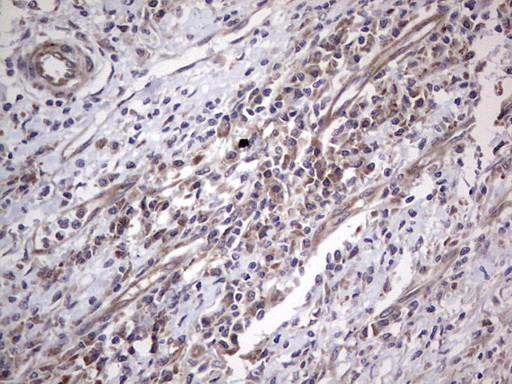 NUDT12 Antibody - IHC of paraffin-embedded Human colon tissue using anti-NUDT12 mouse monoclonal antibody. (Heat-induced epitope retrieval by 1 mM EDTA in 10mM Tris, pH8.5, 120°C for 3min).