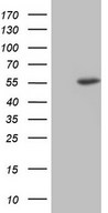 NUDT12 Antibody - HEK293T cells were transfected with the pCMV6-ENTRY control. (Left lane) or pCMV6-ENTRY NUDT12. (Right lane) cDNA for 48 hrs and lysed. Equivalent amounts of cell lysates. (5 ug per lane) were separated by SDS-PAGE and immunoblotted with anti-NUDT12.