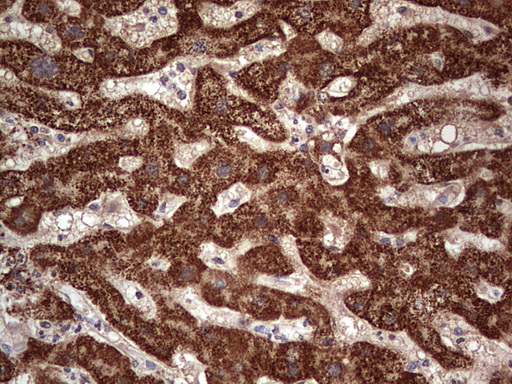 NUDT12 Antibody - Immunohistochemical staining of paraffin-embedded Human liver tissue within the normal limits using anti-NUDT12 mouse monoclonal antibody. (Heat-induced epitope retrieval by 1 mM EDTA in 10mM Tris, pH8.5, 120C for 3min,