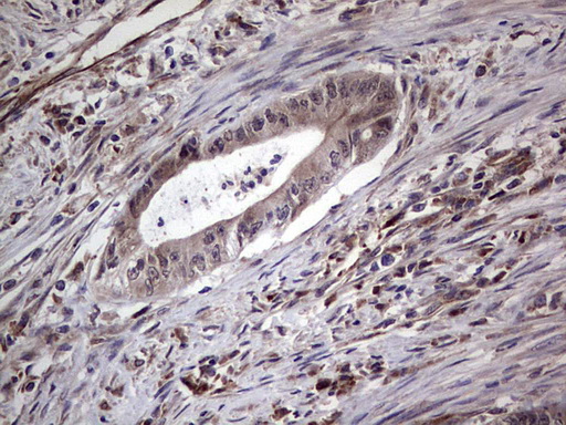 NUDT12 Antibody - Immunohistochemical staining of paraffin-embedded Human colon tissue within the normal limits using anti-NUDT12 mouse monoclonal antibody. (Heat-induced epitope retrieval by 1 mM EDTA in 10mM Tris, pH8.5, 120C for 3min,