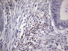 NUDT12 Antibody - Immunohistochemical staining of paraffin-embedded Human colon tissue within the normal limits using anti-NUDT12 mouse monoclonal antibody. (Heat-induced epitope retrieval by 1 mM EDTA in 10mM Tris, pH8.5, 120C for 3min,