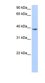NUDT13 Antibody - NUDT13 antibody NUDT13(nudix (nucleoside diphosphate linked moiety X)-type motif 13) Antibody Western blot of HepG2 cell lysate.  This image was taken for the unconjugated form of this product. Other forms have not been tested.