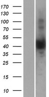 NUDT13 Protein - Western validation with an anti-DDK antibody * L: Control HEK293 lysate R: Over-expression lysate