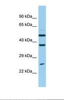 NUDT14 Antibody - Western blot of Human ACHN. NUDT14 antibody dilution 1.0 ug/ml.  This image was taken for the unconjugated form of this product. Other forms have not been tested.