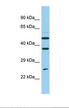 NUDT14 Antibody - Western blot of Human ACHN. NUDT14 antibody dilution 1.0 ug/ml.  This image was taken for the unconjugated form of this product. Other forms have not been tested.