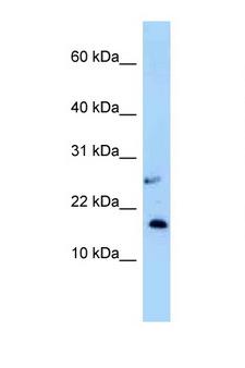 NUDT15 Antibody - NUDT15 antibody Western blot of Small Intestine lysate. Antibody concentration 1 ug/ml.  This image was taken for the unconjugated form of this product. Other forms have not been tested.