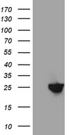 NUDT15 Antibody - HEK293T cells were transfected with the pCMV6-ENTRY control. (Left lane) or pCMV6-ENTRY NUDT15. (Right lane) cDNA for 48 hrs and lysed. Equivalent amounts of cell lysates. (5 ug per lane) were separated by SDS-PAGE and immunoblotted with anti-NUDT15. (1:2000)
