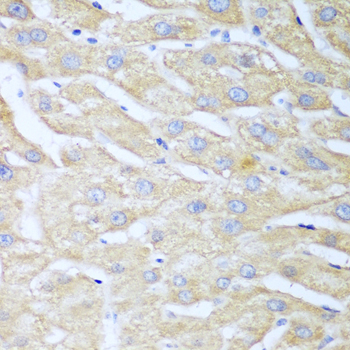 NUDT15 Antibody - Immunohistochemistry of paraffin-embedded human liver tissue.