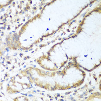 NUDT15 Antibody - Immunohistochemistry of paraffin-embedded human stomach tissue.
