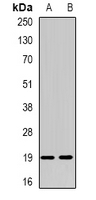 NUDT15 Antibody - Western blot analysis of NUDT15 expression in HT29 (A); SW480 (B) whole cell lysates.