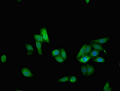 NUDT15 Antibody - Immunofluorescent analysis of HepG2 cells at a dilution of 1:100 and Alexa Fluor 488-congugated AffiniPure Goat Anti-Rabbit IgG(H+L)