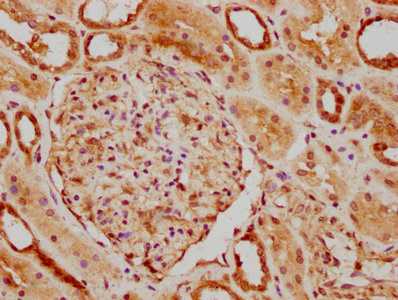 NUDT15 Antibody - IHC image of NUDT15 Antibody diluted at 1:300 and staining in paraffin-embedded human kidney tissue performed on a Leica BondTM system. After dewaxing and hydration, antigen retrieval was mediated by high pressure in a citrate buffer (pH 6.0). Section was blocked with 10% normal goat serum 30min at RT. Then primary antibody (1% BSA) was incubated at 4°C overnight. The primary is detected by a biotinylated secondary antibody and visualized using an HRP conjugated SP system.