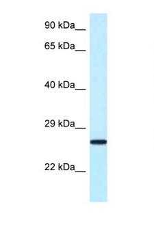 NUDT16 Antibody - Nudt16 antibody Western blot of Small Intestine lysate. Antibody concentration 1 ug/ml.  This image was taken for the unconjugated form of this product. Other forms have not been tested.