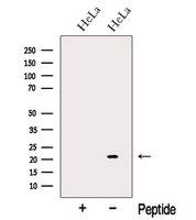 NUDT16 Antibody - Western blot analysis of extracts of HeLa cells using NUDT16 antibody. The lane on the left was treated with blocking peptide.