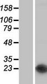 NUDT16 Protein - Western validation with an anti-DDK antibody * L: Control HEK293 lysate R: Over-expression lysate