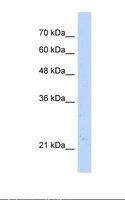 NUDT16L1 Antibody - HepG2 cell lysate. Antibody concentration: 5.0 ug/ml. Gel concentration: 12%.  This image was taken for the unconjugated form of this product. Other forms have not been tested.
