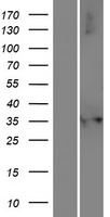 NUDT17 Protein - Western validation with an anti-DDK antibody * L: Control HEK293 lysate R: Over-expression lysate