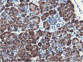 NUDT18 Antibody - IHC of paraffin-embedded Human pancreas tissue using anti-NUDT18 mouse monoclonal antibody.