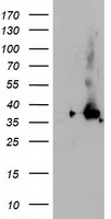 NUDT18 Antibody - HEK293T cells were transfected with the pCMV6-ENTRY control (Left lane) or pCMV6-ENTRY NUDT18 (Right lane) cDNA for 48 hrs and lysed. Equivalent amounts of cell lysates (5 ug per lane) were separated by SDS-PAGE and immunoblotted with anti-NUDT18.