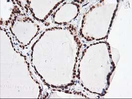 NUDT18 Antibody - IHC of paraffin-embedded Human thyroid tissue using anti-NUDT18 mouse monoclonal antibody.