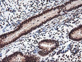 NUDT18 Antibody - IHC of paraffin-embedded Human endometrium tissue using anti-NUDT18 mouse monoclonal antibody.