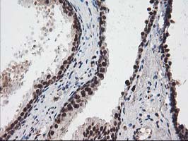 NUDT18 Antibody - IHC of paraffin-embedded Human prostate tissue using anti-NUDT18 mouse monoclonal antibody.