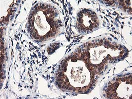NUDT18 Antibody - IHC of paraffin-embedded Human breast tissue using anti-NUDT18 mouse monoclonal antibody.