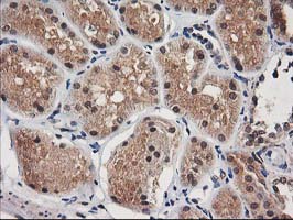 NUDT18 Antibody - IHC of paraffin-embedded Human Kidney tissue using anti-NUDT18 mouse monoclonal antibody.