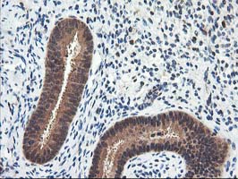 NUDT18 Antibody - IHC of paraffin-embedded Human endometrium tissue using anti-NUDT18 mouse monoclonal antibody.