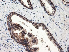 NUDT18 Antibody - IHC of paraffin-embedded Human prostate tissue using anti-NUDT18 mouse monoclonal antibody.