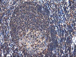 NUDT18 Antibody - IHC of paraffin-embedded Human tonsil using anti-NUDT18 mouse monoclonal antibody.