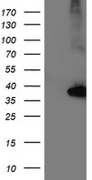 NUDT18 Antibody - HEK293T cells were transfected with the pCMV6-ENTRY control (Left lane) or pCMV6-ENTRY NUDT18 (Right lane) cDNA for 48 hrs and lysed. Equivalent amounts of cell lysates (5 ug per lane) were separated by SDS-PAGE and immunoblotted with anti-NUDT18.